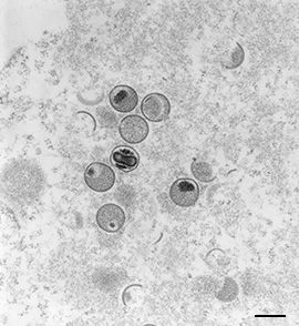 Alerta a la comunidad médica por viruela símica (monkeypox)